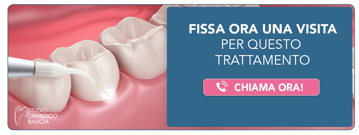 cura-della-parodontite-o-piorrea-con-laser Cavenago di Brianza (MB) e Castano Primo (Milano)
