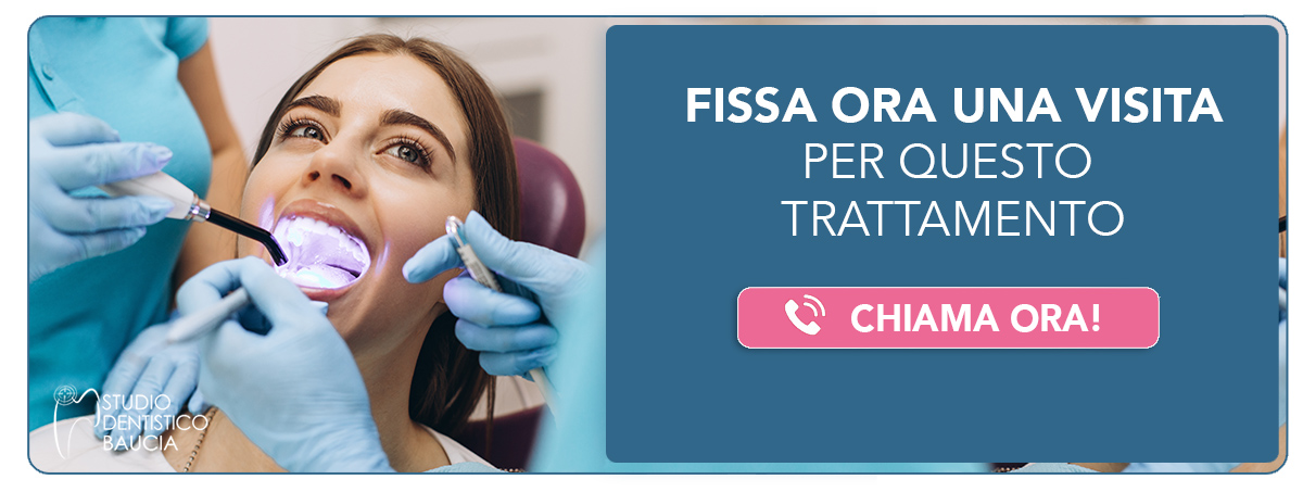 sbiancamento-dentale-professionale Cavenago di Brianza (MB) e Castano Primo (Milano)